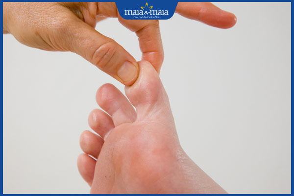 Triệu chứng nấm kẽ chân và các biện pháp điều trị hiệu quả 3 cơ địa nhiều mồ hôi chân