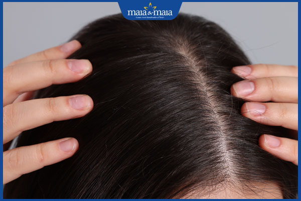 da đầu đang phục hồi