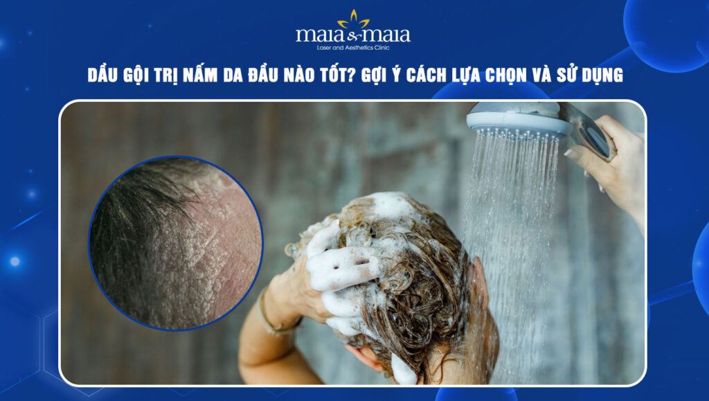 dầu gội trị nấm da đầu