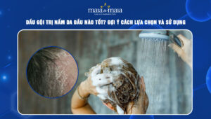 dầu gội trị nấm da đầu
