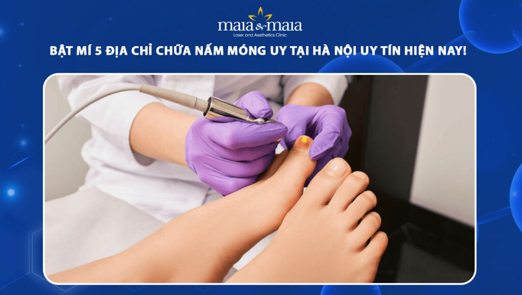 địa chỉ chữa nấm móng
