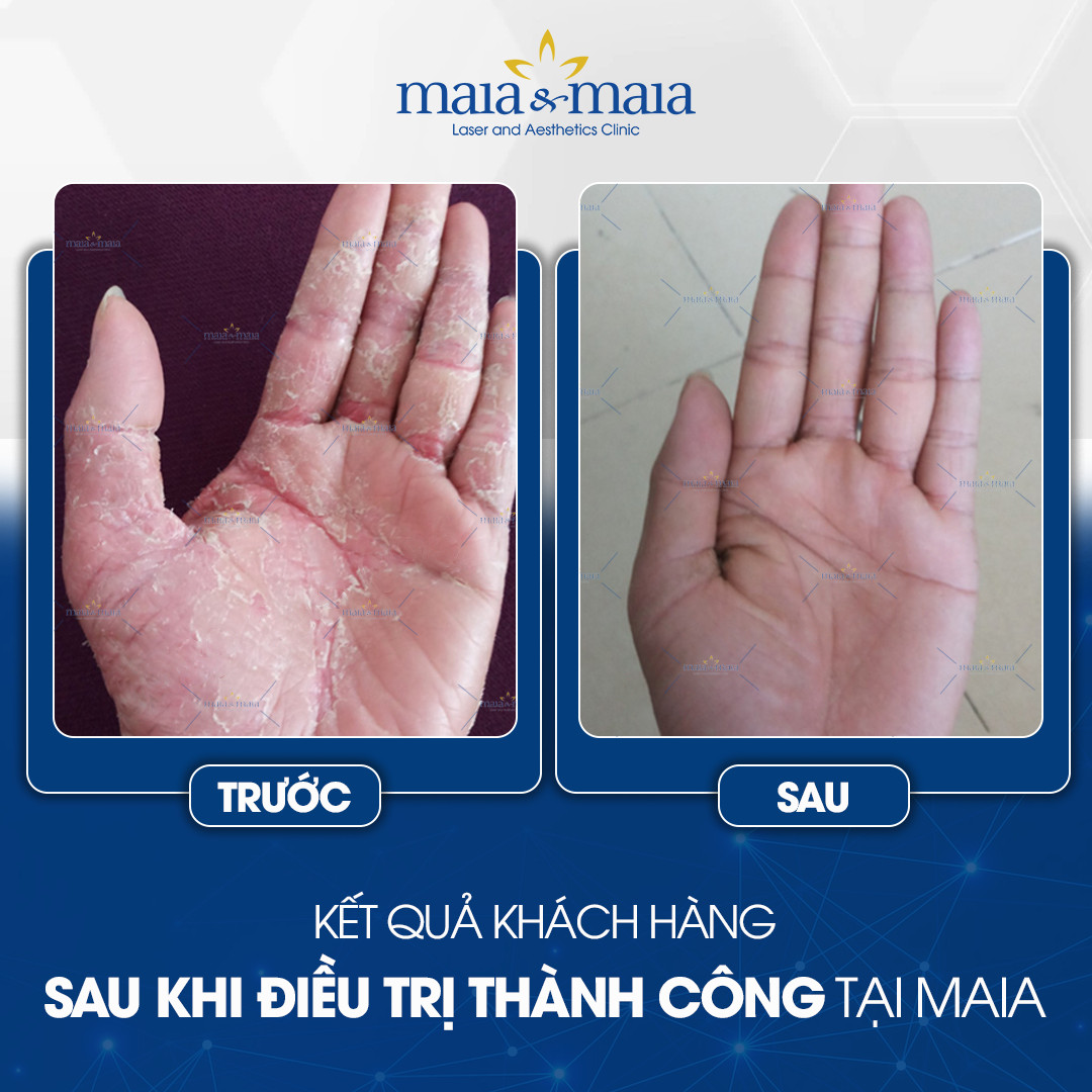 feedback viem da co dia 5