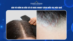 Gàu và nấm da đầu