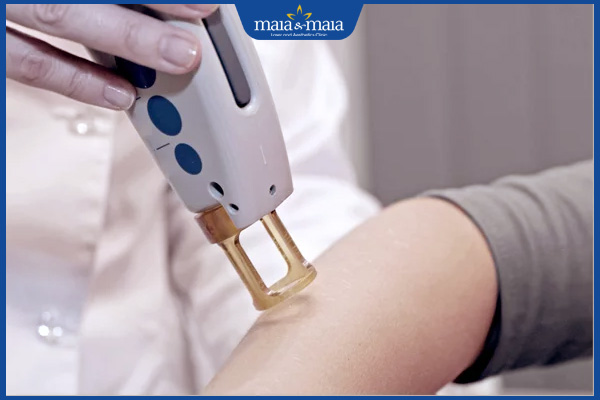 Nấm da có chữa được không? Giải pháp điều trị hiệu quả nhất 4 laser điều trị bệnh nấm