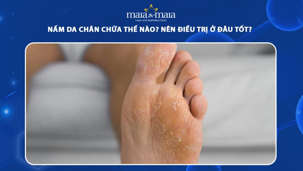 nấm da chân