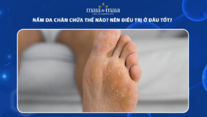 nấm da chân