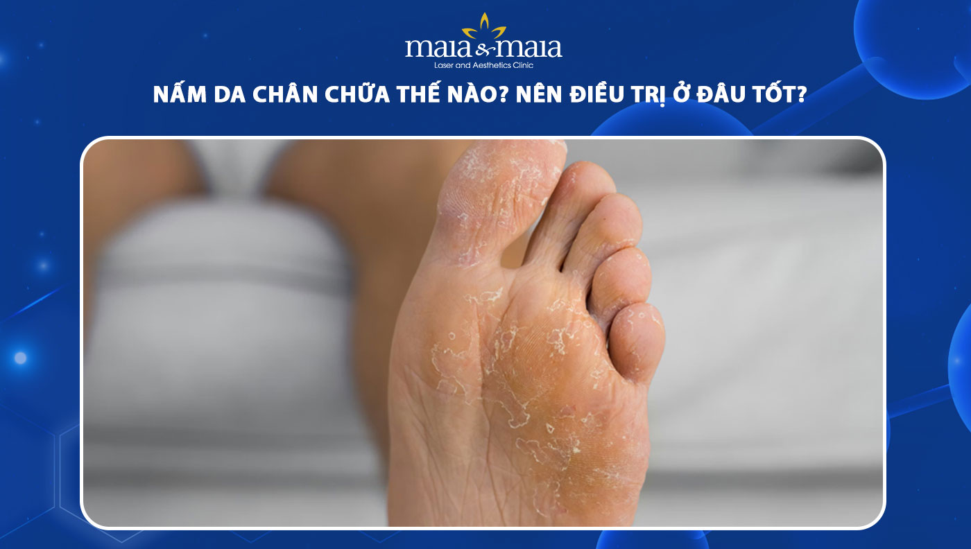 nấm da chân