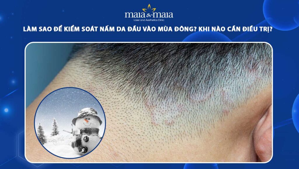 nấm da đầu vào mùa đông