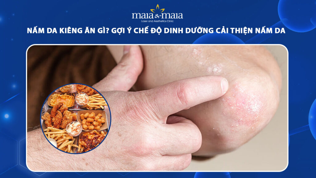 Nấm da kiêng ăn gì? Gợi ý chế độ ăn để cải thiện nấm da 1 nấm da kiêng ăn gì