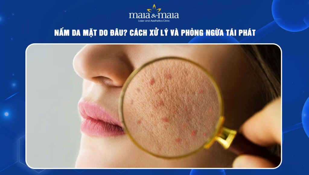 Nấm da mặt do đâu? Cách xử lý và phòng ngừa tái phát 1 Nấm da mặt