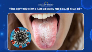 nấm miệng hiv