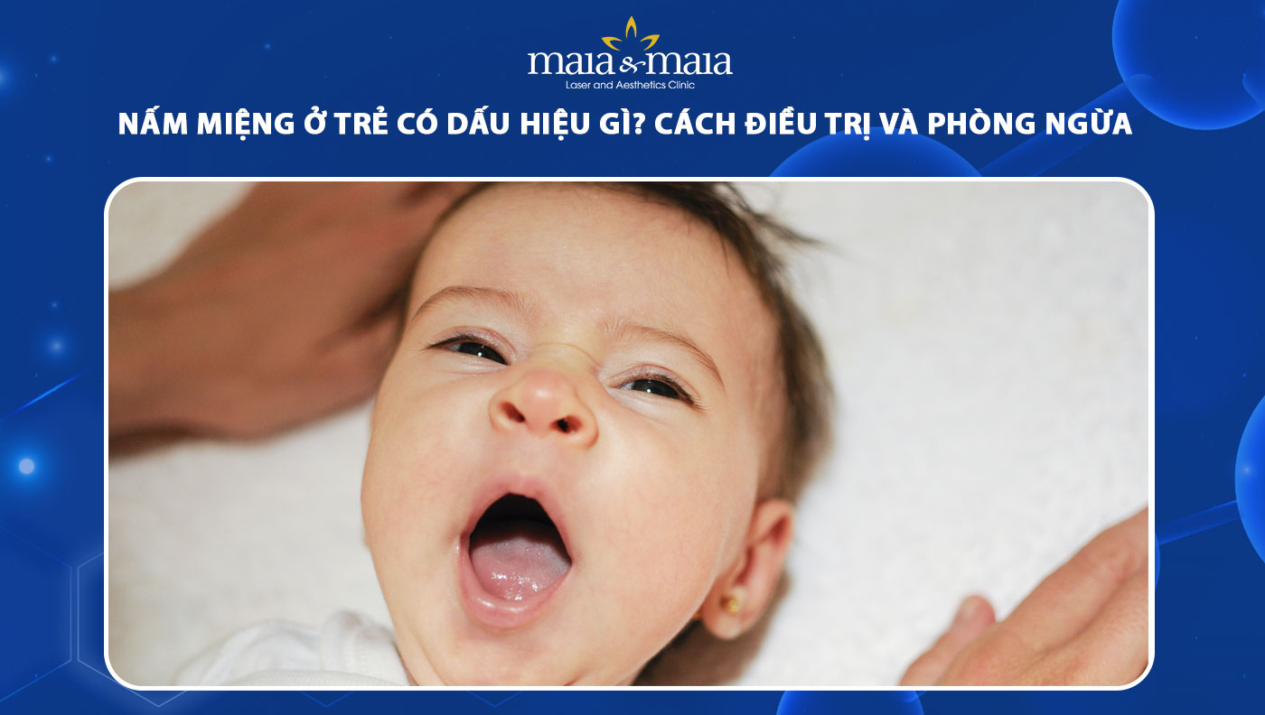 nấm miệng ở trẻ