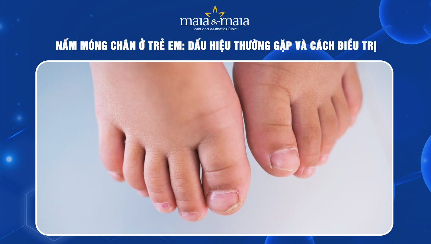 Nấm móng chân ở trẻ em