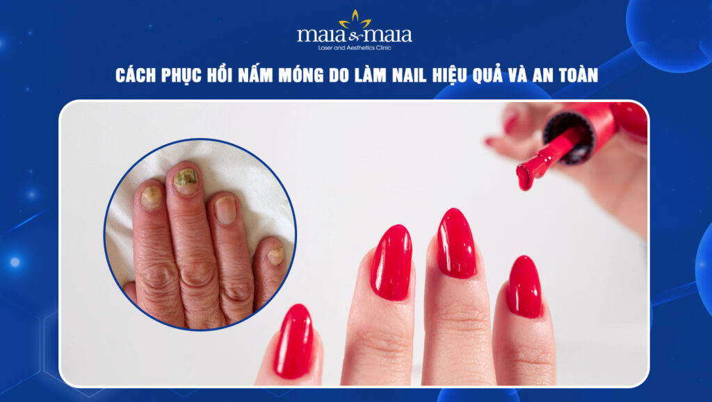 nấm móng do làm nail