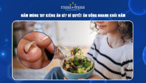 nấm móng tay kiêng ăn gì
