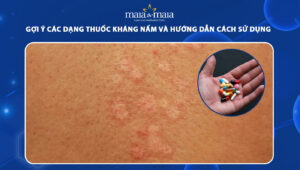 thuốc kháng nấm