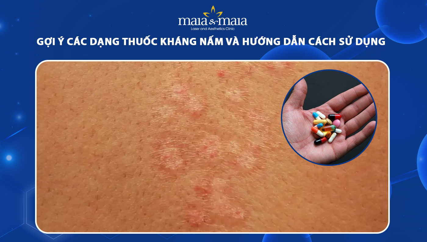 thuốc kháng nấm