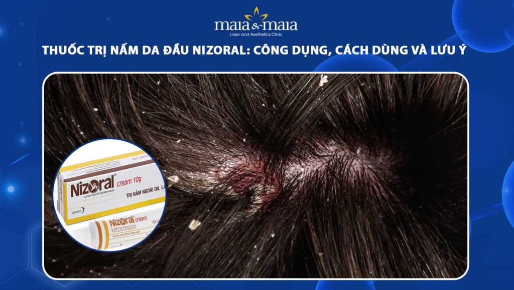 thuốc trị nấm da đầu Nizoral