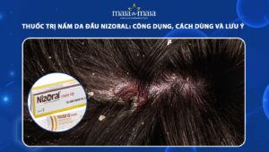 thuốc trị nấm da đầu Nizoral