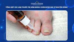 thuốc trị nấm móng chân