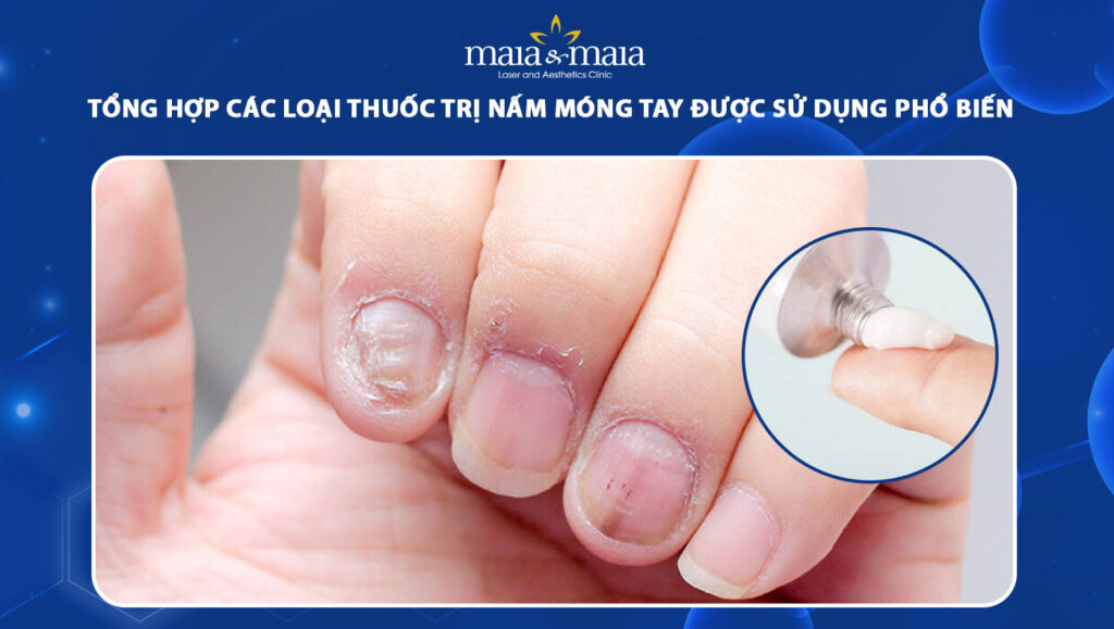 thuốc trị nấm móng tay