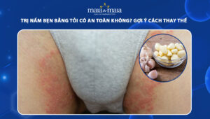 trị nấm bẹn bằng tỏi
