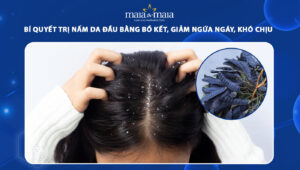trị nấm da đầu bằng bồ kết