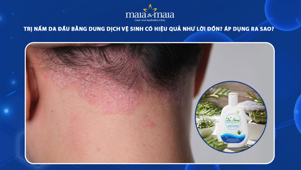 trị nấm da đầu bằng dung dịch vệ sinh