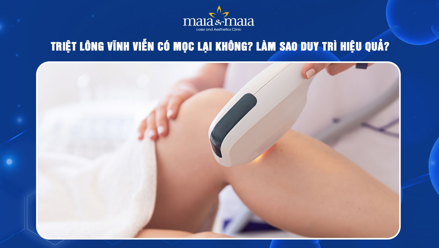 Triệt lông vĩnh viễn có mọc lại không