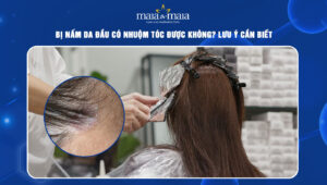 Bị nấm da đầu có nhuộm tóc được không