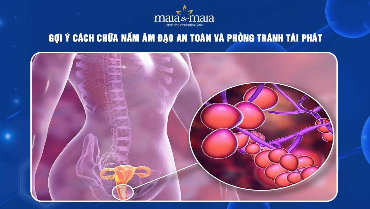 cách chữa nấm âm đạo