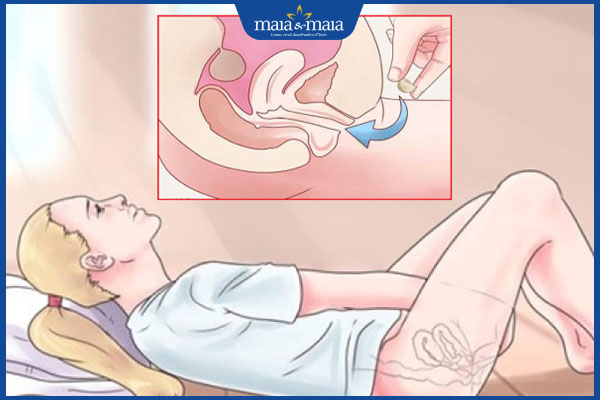 cách đặt thuốc phụ khoa