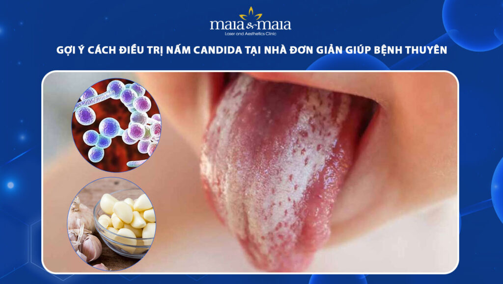 cách điều trị nấm candida tại nhà