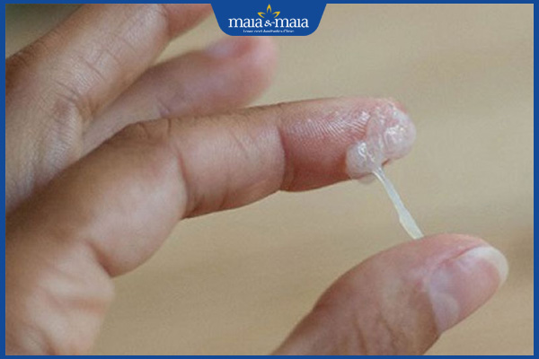 dịch nhầy trắng đục