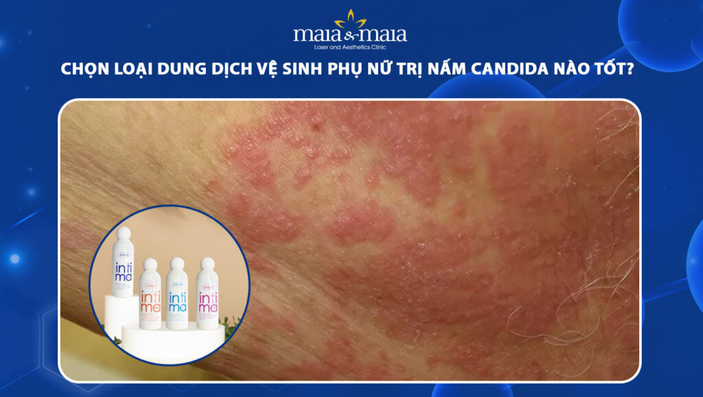dung dịch vệ sinh phụ nữ trị nấm candida