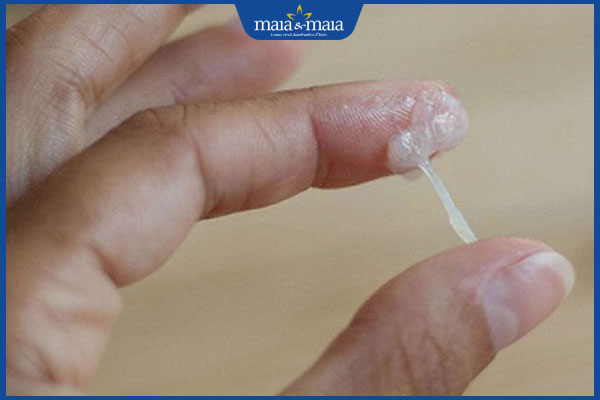 Tổng hợp hình ảnh nấm Candida để nhận biết bệnh nhanh chóng 3 khí hư trắng đục