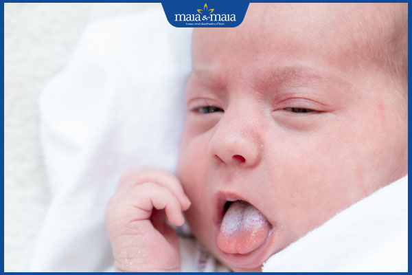 mảng trắng lan rộng