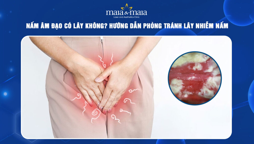 nấm âm đạo có lây không