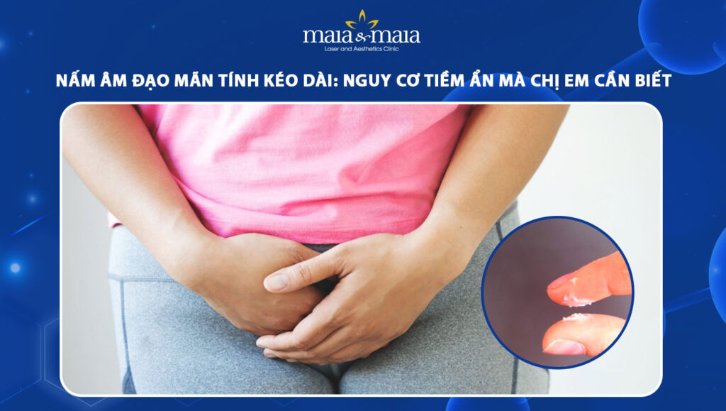 nấm âm đạo mãn tính