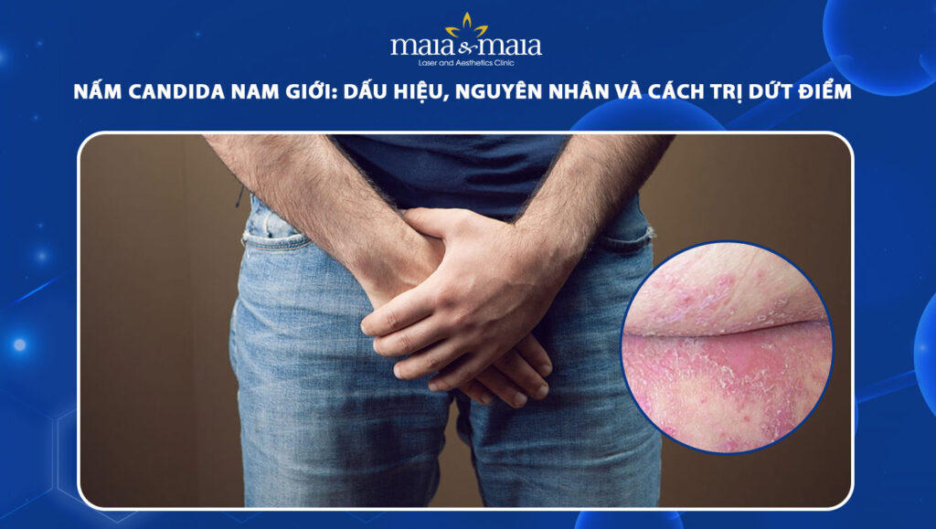 Nấm candida ở nam giới: Dấu hiệu và cách điều trị dứt điểm 1 nấm candida ở nam giới