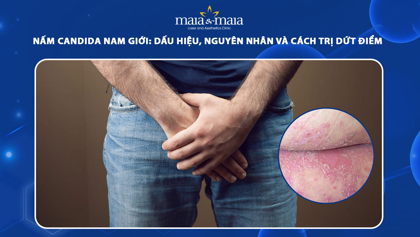nấm candida ở nam giới