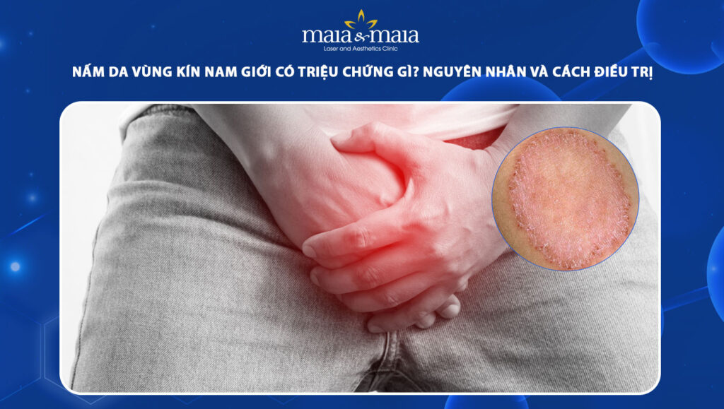 nấm da vùng kín nam giới