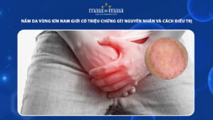 nấm da vùng kín nam giới
