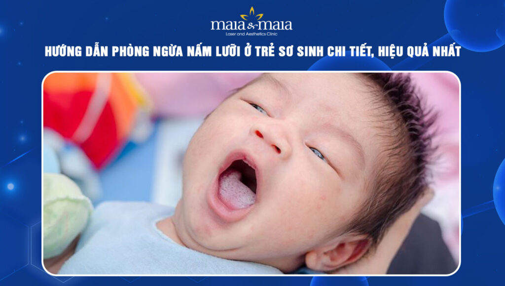 nấm lưỡi ở trẻ sơ sinh