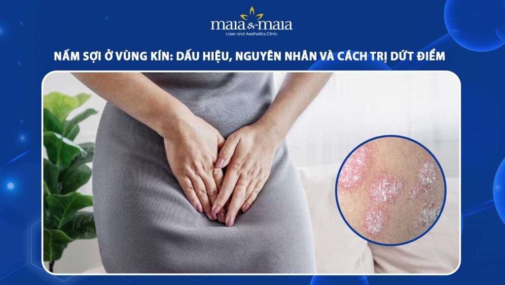 nấm sợi ở vùng kín