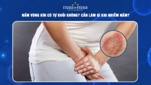 nấm vùng kín có tự khỏi không