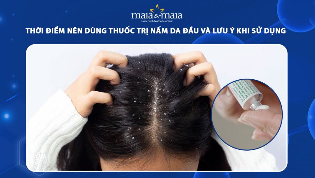 Thời điểm nên dùng thuốc trị nấm da đầu và lưu ý khi sử dụng 1 thuốc trị nấm da đầu