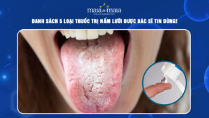 thuốc trị nấm lưỡi