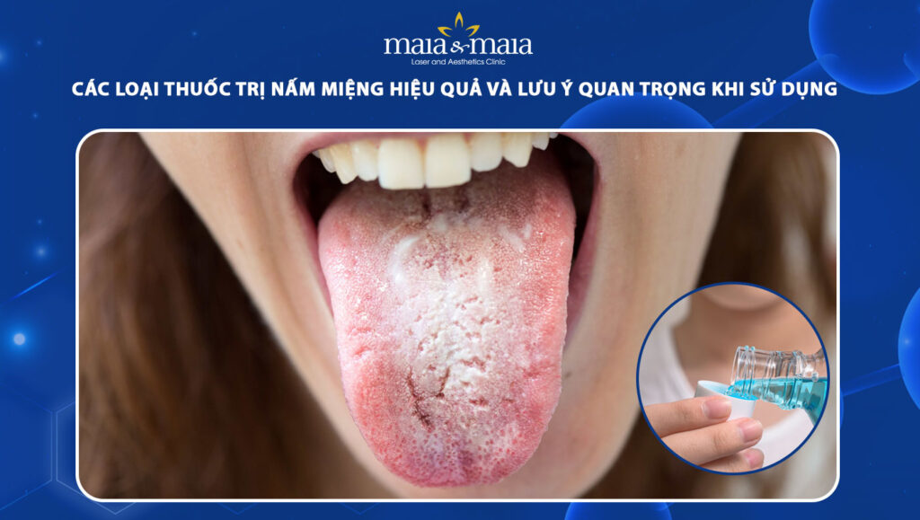 thuốc trị nấm miệng