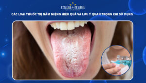 thuốc trị nấm miệng